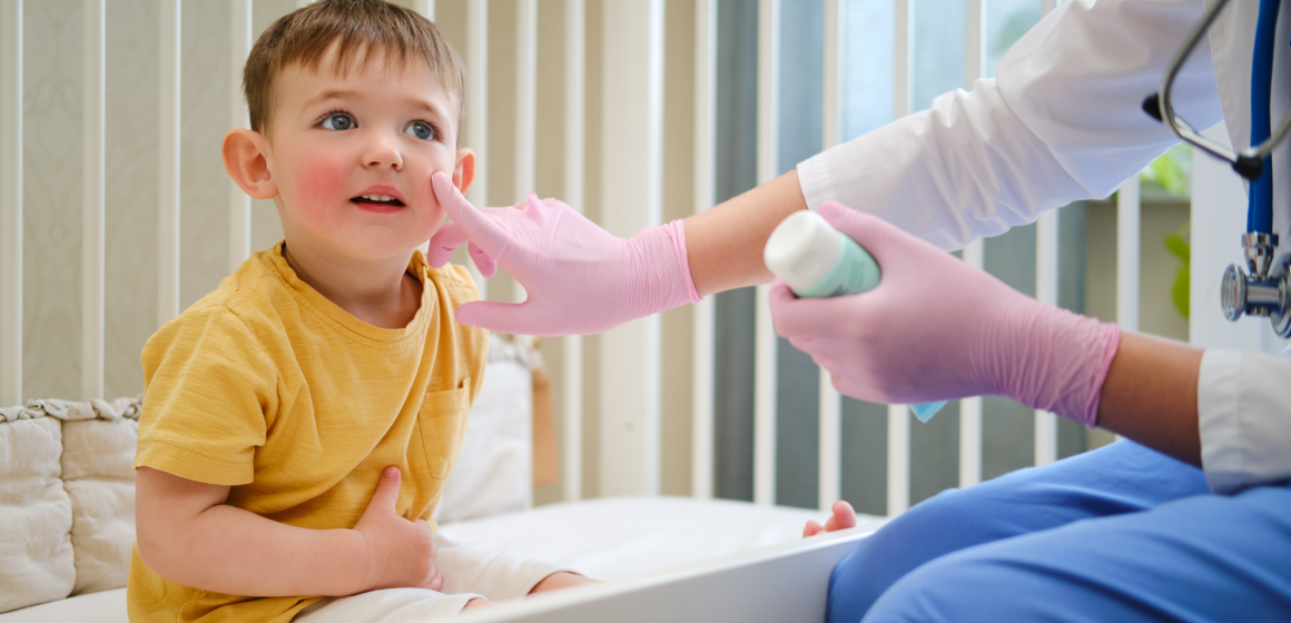 Recognizing and Treating Common Childhood Skin Conditions- Understanding Eczema Rashes and More-Blog Images MHA