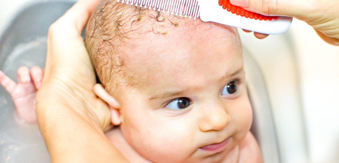 Common Skin Conditions in Newborns_ Cradle Cap, Eczema, and Diaper Rash - MHA Blog Featured IMG