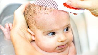 Common Skin Conditions in Newborns_ Cradle Cap, Eczema, and Diaper Rash - MHA Blog Featured IMG
